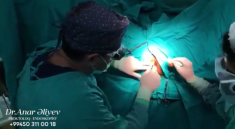 Лазерная хирургия геморроя - новейший метод
